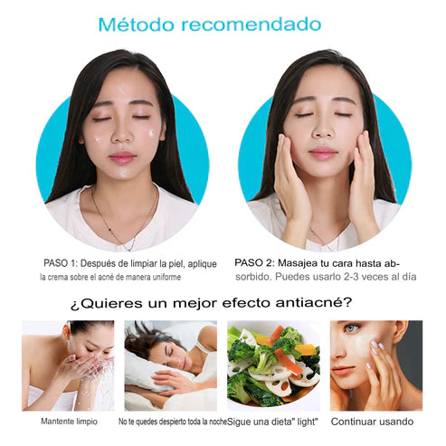 Crema Antiacné