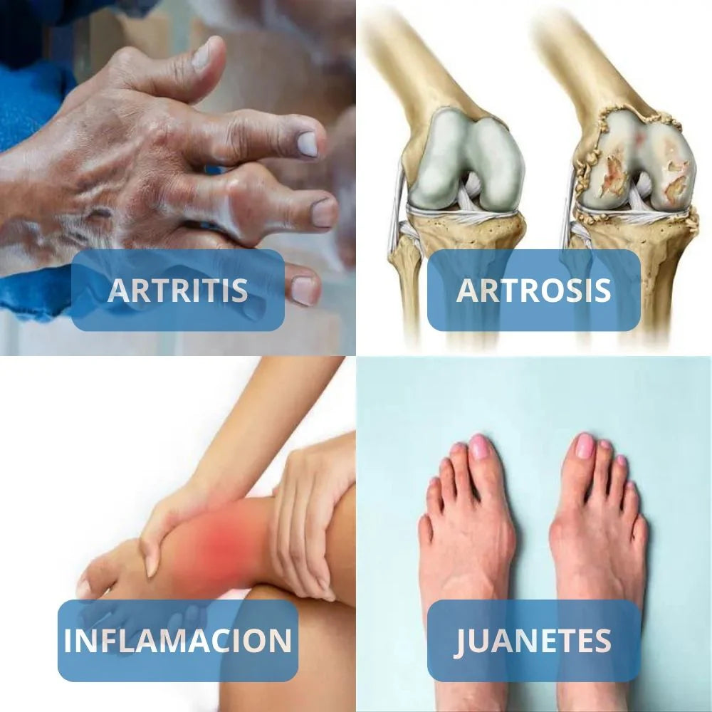 Crema Para Dolores Musculares