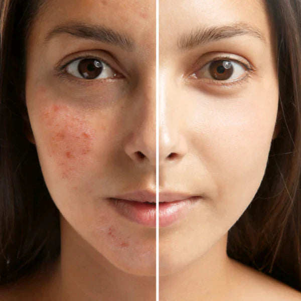 Niacinamide 10