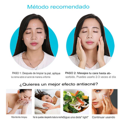 Crema Antiacné