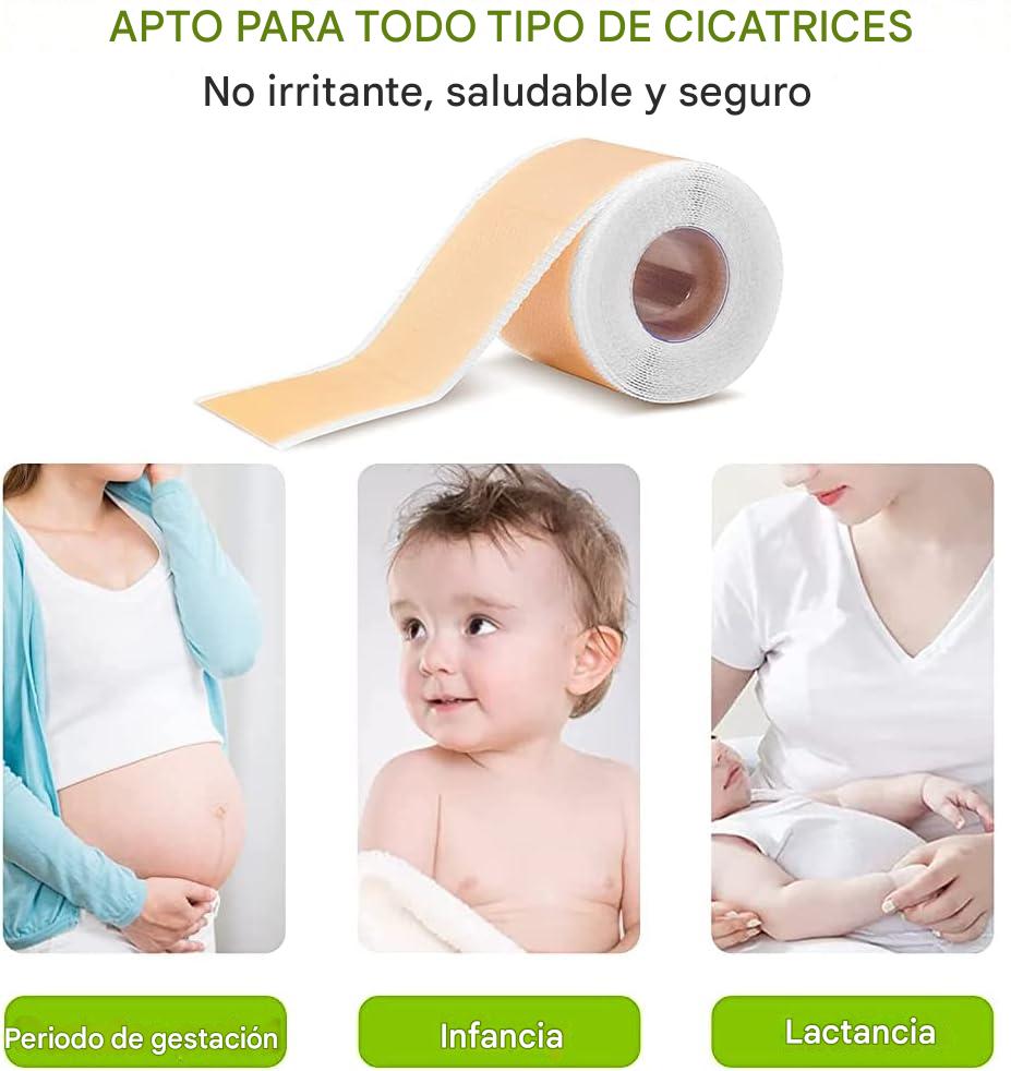 Cinta De Silicona Para Cicatrices