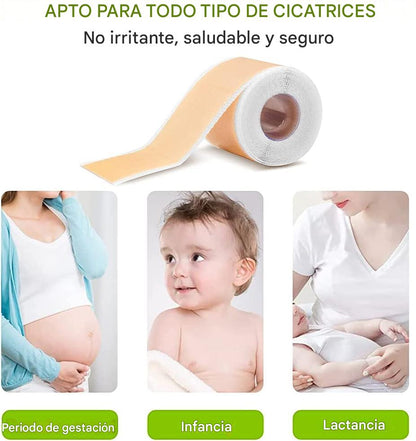 Cinta De Silicona Para Cicatrices