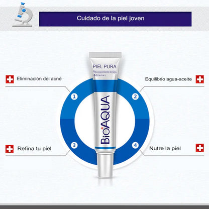 Crema Antiacné